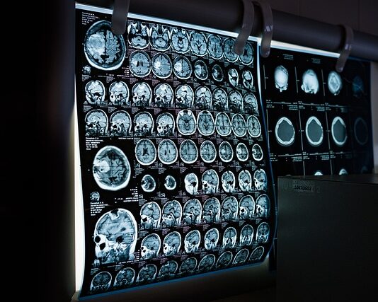 Co jest droższe rezonans czy tomografia?